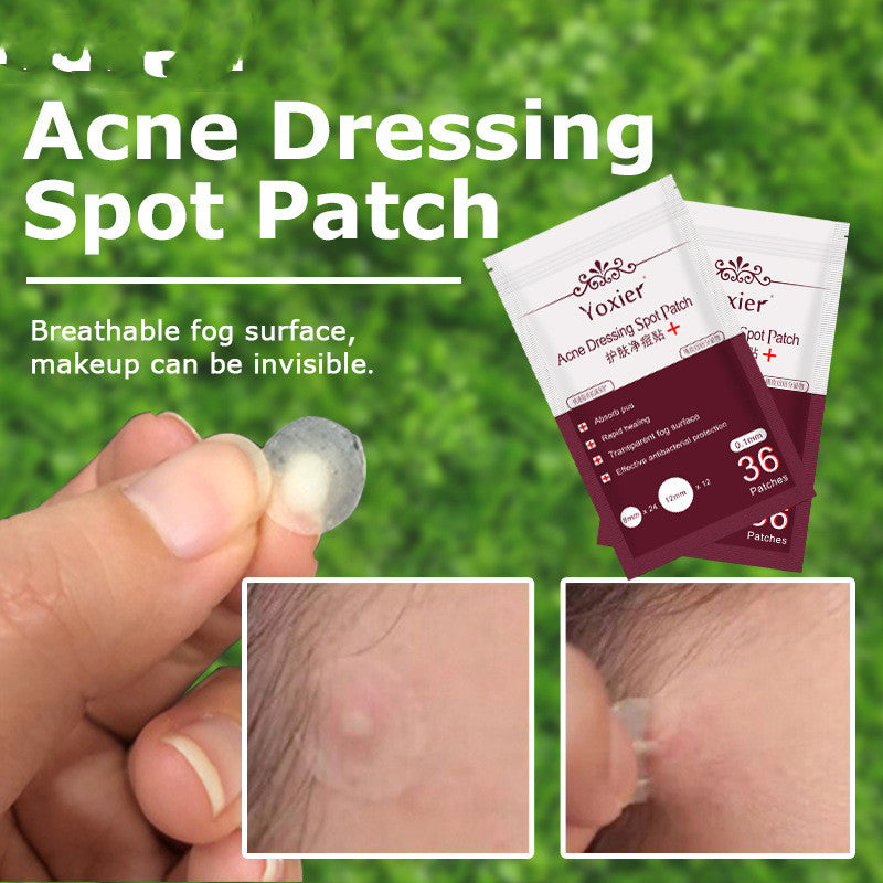 Acne Pimple Patches Fast Healing Invisible | Hydrocolloid Proof