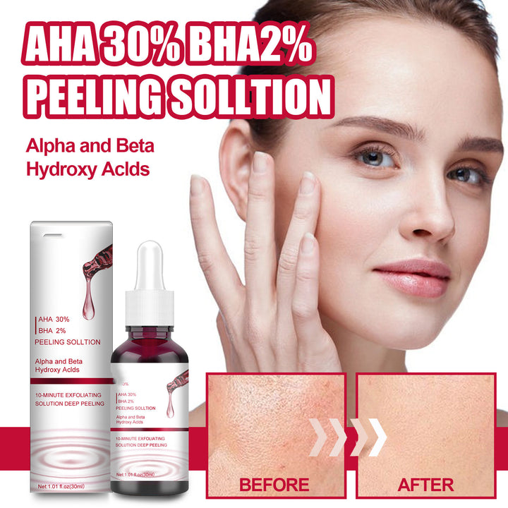 Salicylic Acid Acne Treatment Clear Skin Fast | Dermatology Grade
