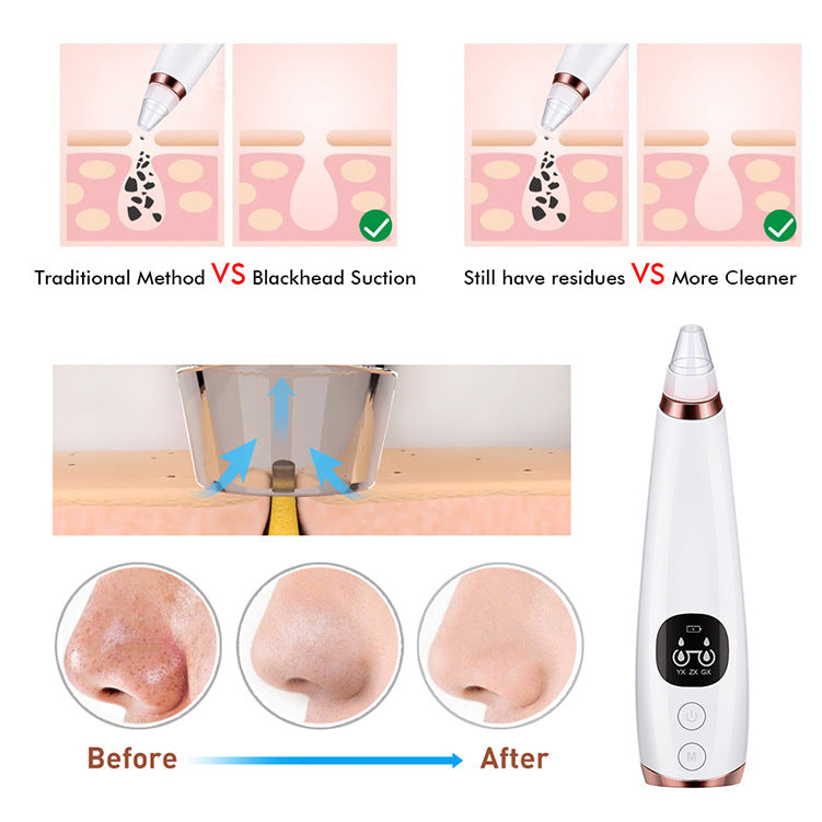 Blackhead Vacuum Suction Device — Deep Pore Extractor & Skin Tightening Tool | USB Rechargeable