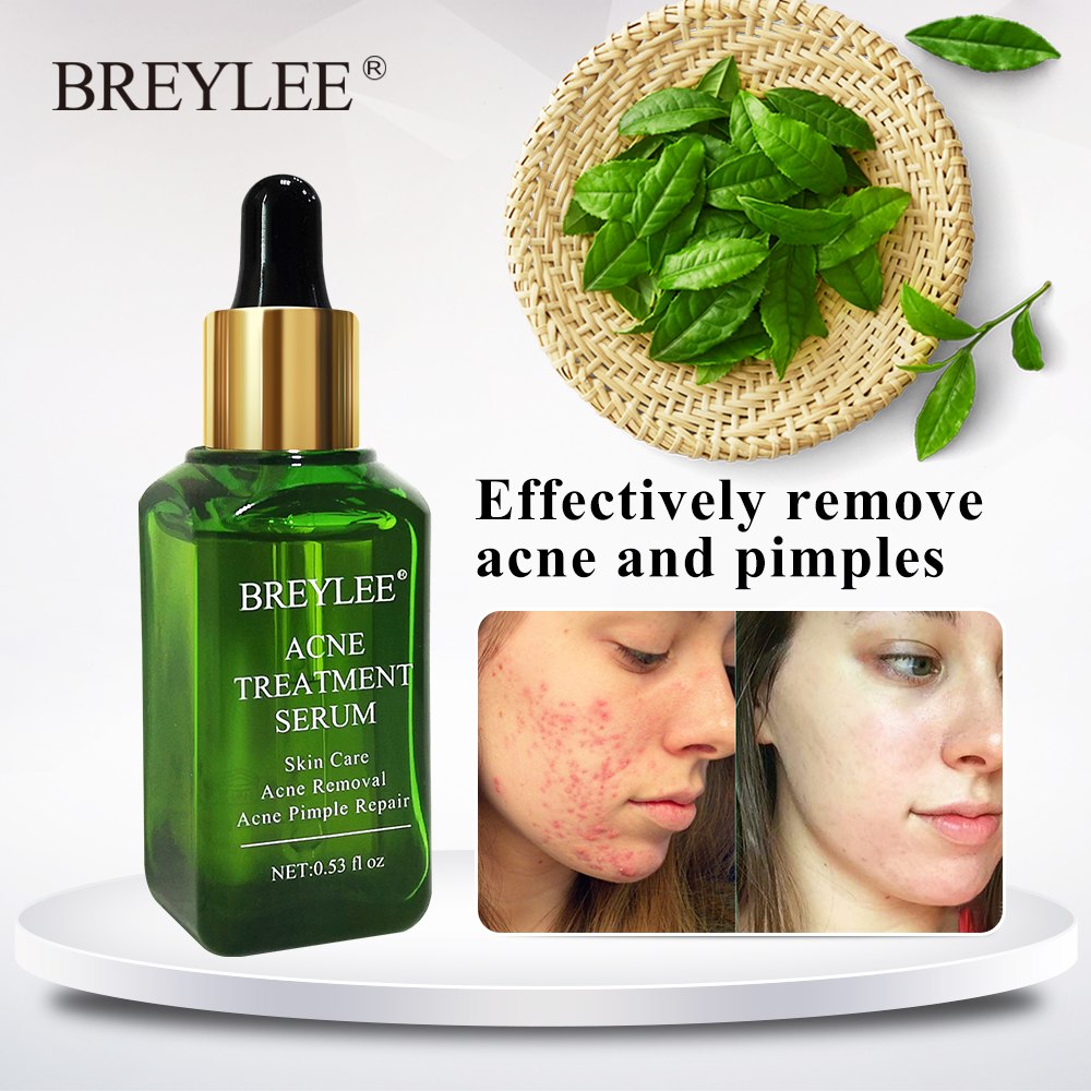 Acne Treatment Serum Fast Clear Skin | Visible Results in Days