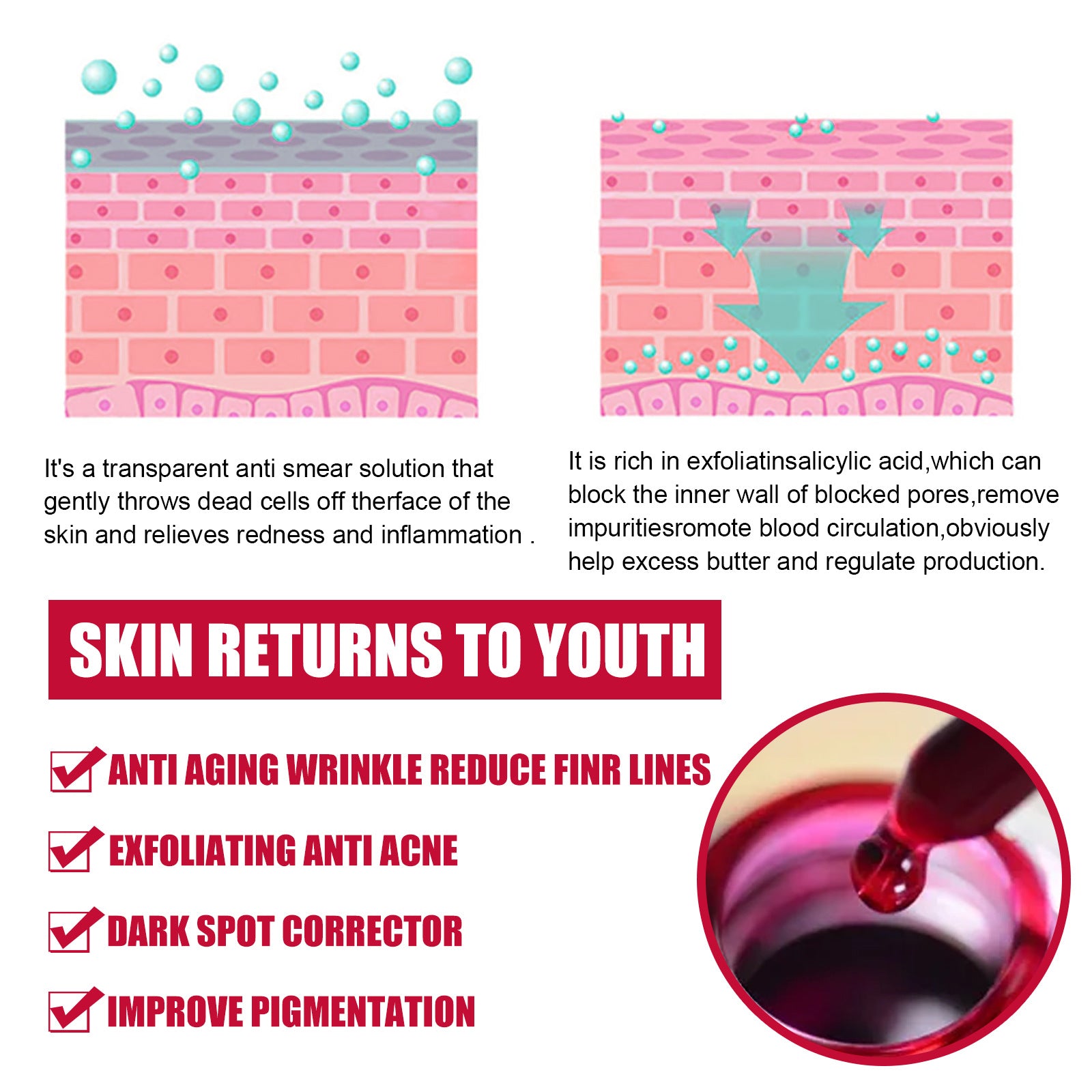 Salicylic Acid Acne Treatment Clear Skin Fast | Dermatology Grade