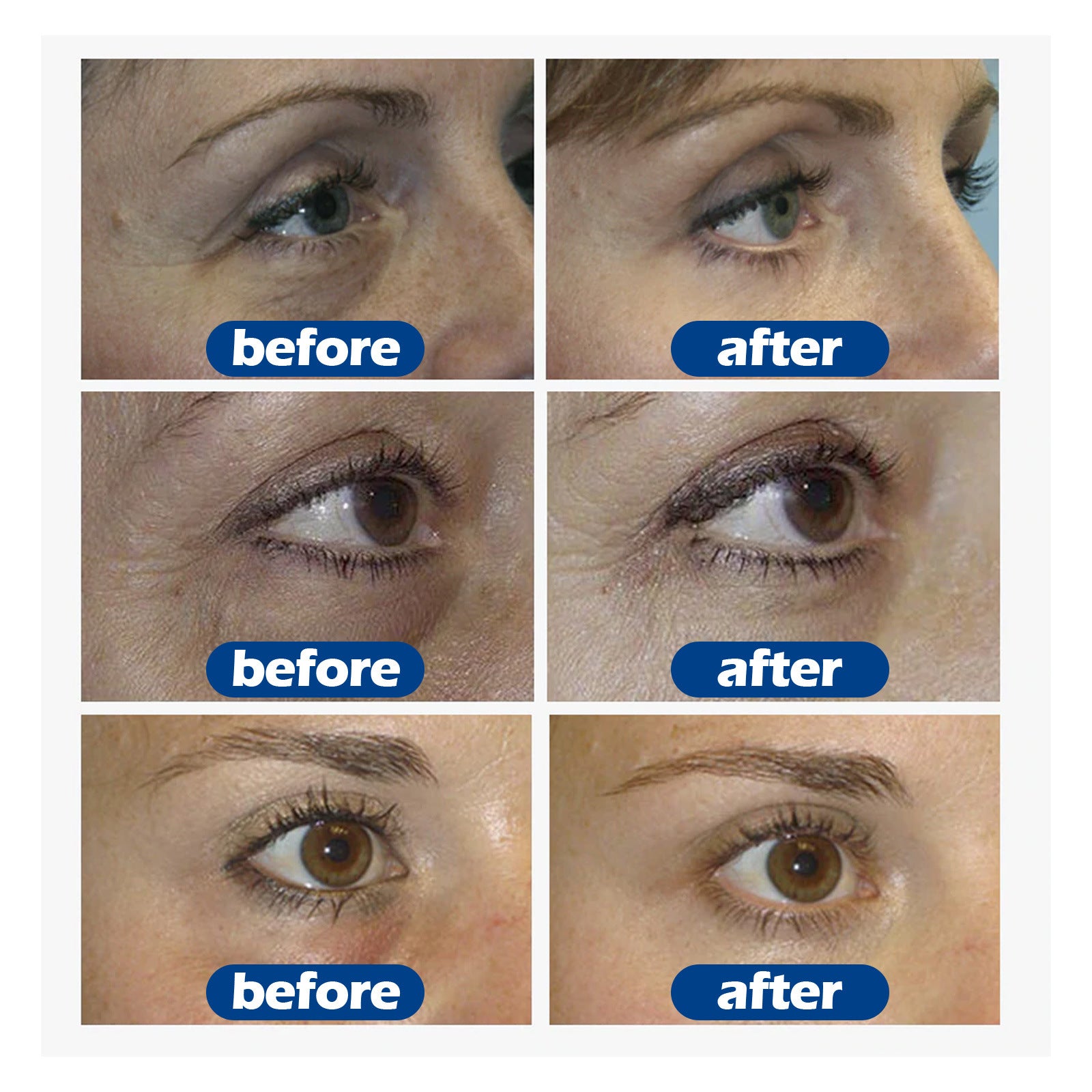 Collagen Eye Cream for Dark Circles & Puffiness | Fast Visible Results