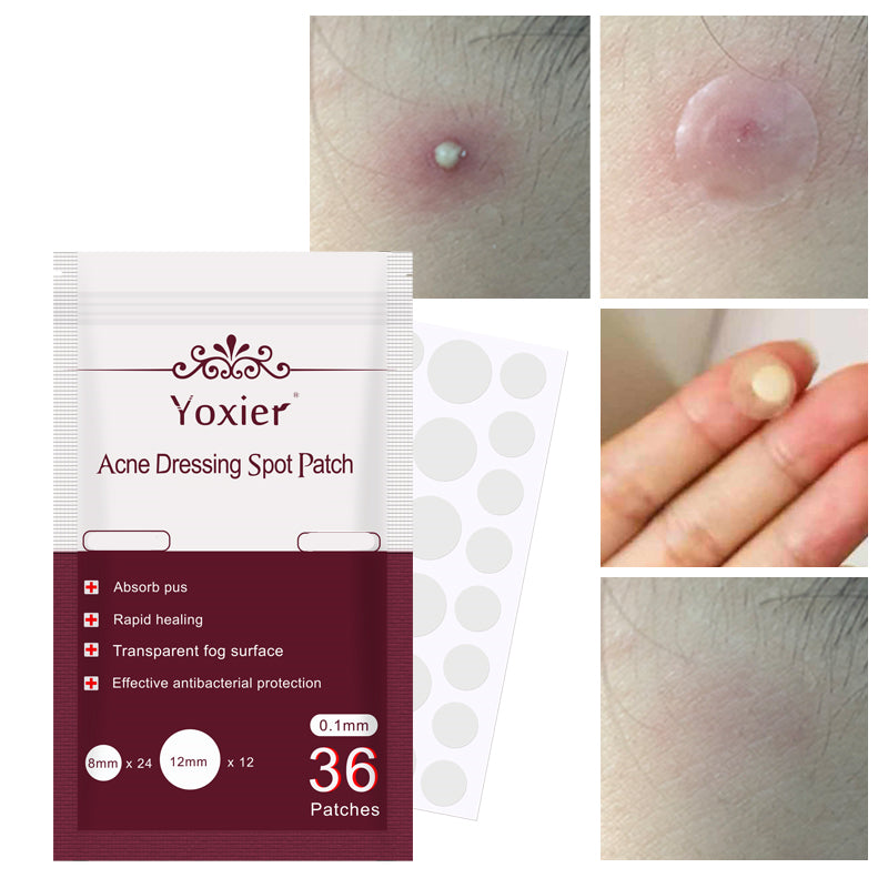 Acne Pimple Patches Fast Healing Invisible | Hydrocolloid Proof