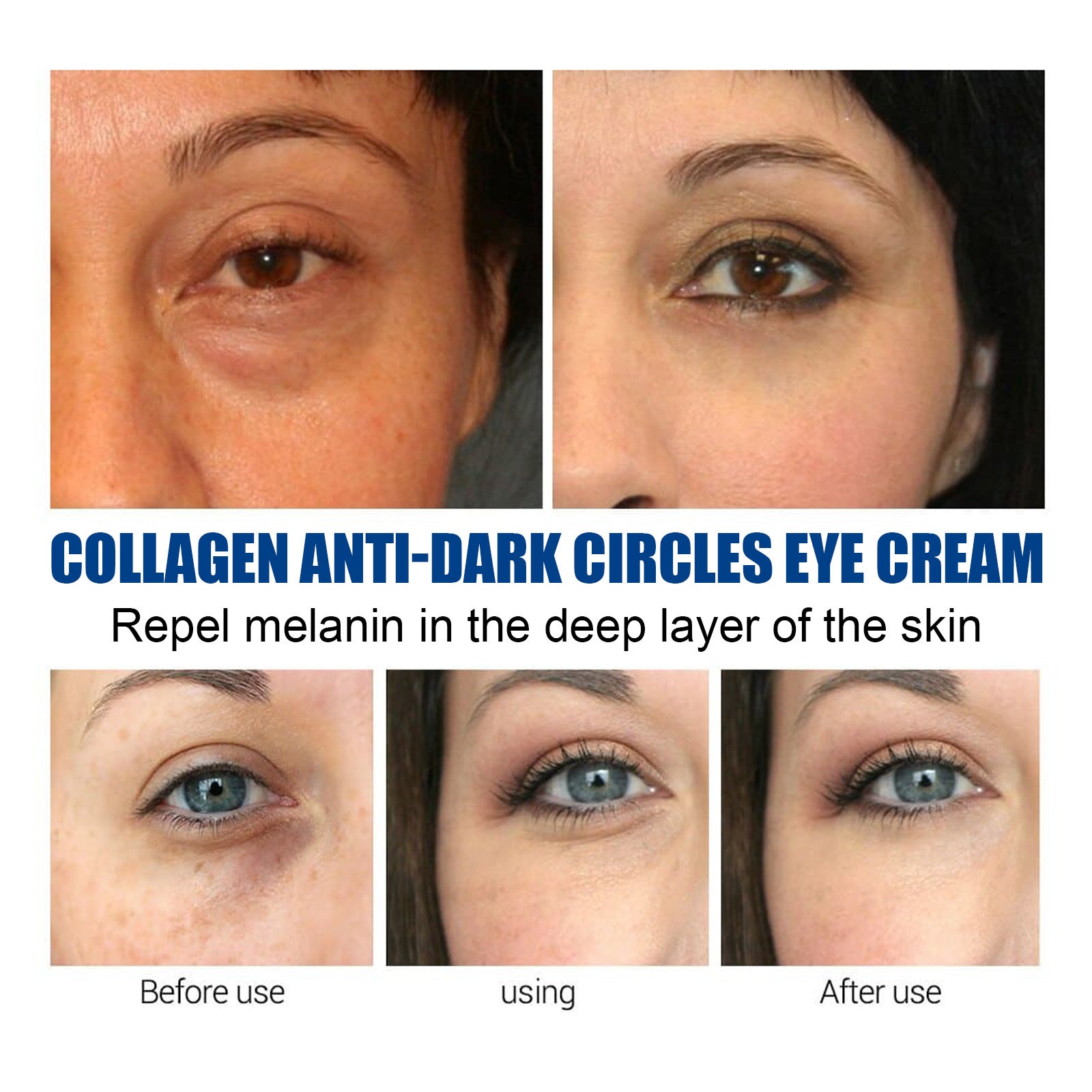Collagen Eye Cream for Dark Circles & Puffiness | Fast Visible Results