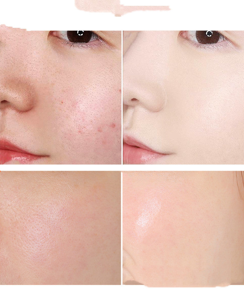 Salicylic Acid Serum Clear Pores Fast | Dermatologist-Tested